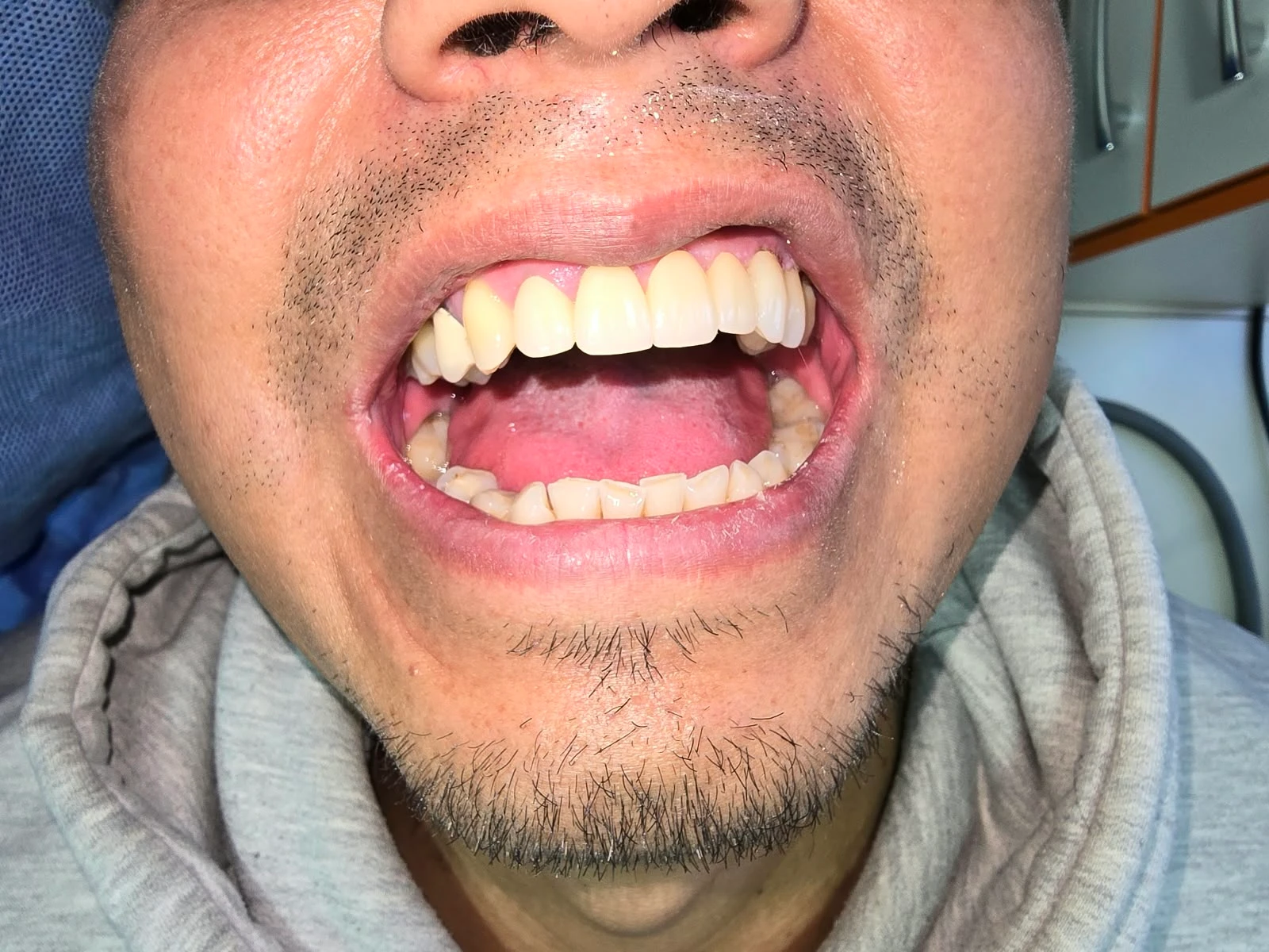 Resultado después del tratamiento odontológico